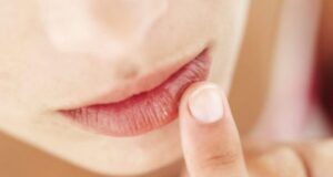 ako vyliečiť herpes