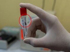 Čo treba robiť, keď máte pozitívny test na COVID-19?