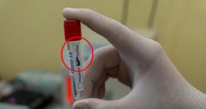 Čo treba robiť, keď máte pozitívny test na COVID-19?