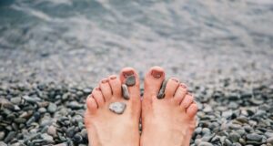 Vybočené palce hallux